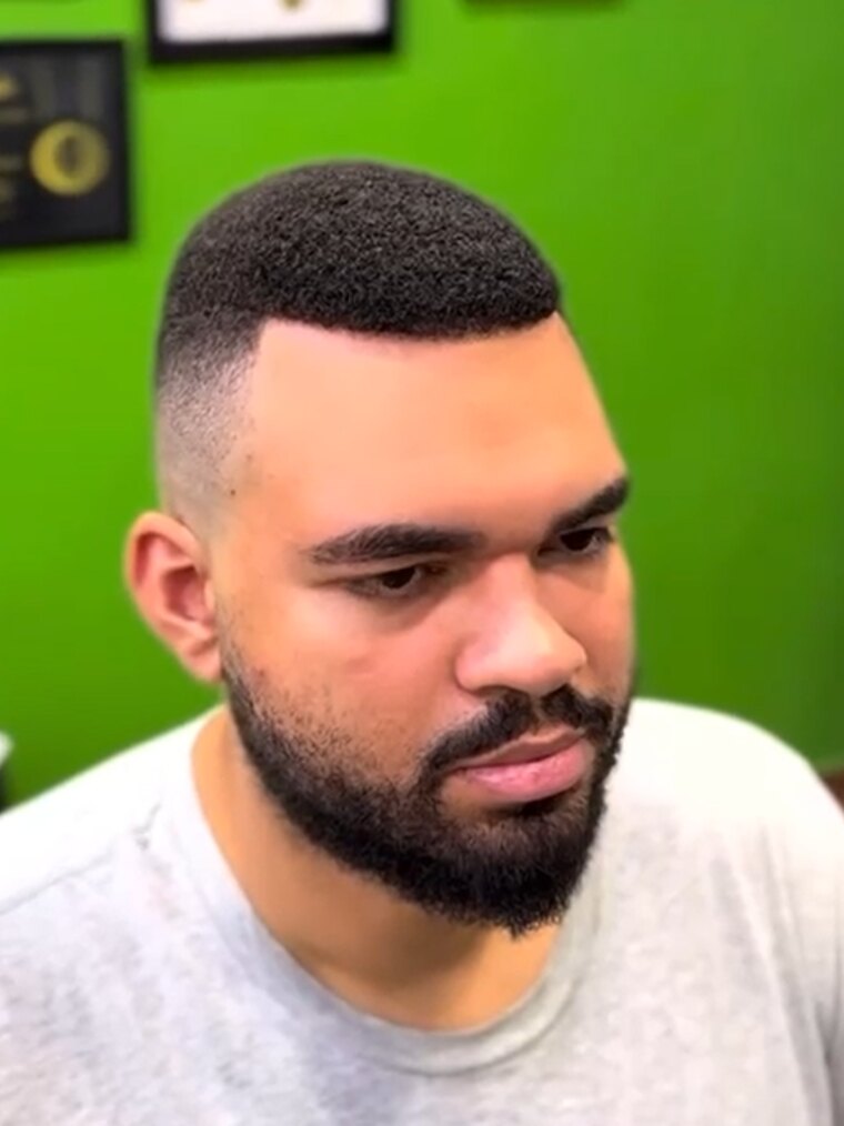 Depois — cabelo natural com prótese capilar do Zé